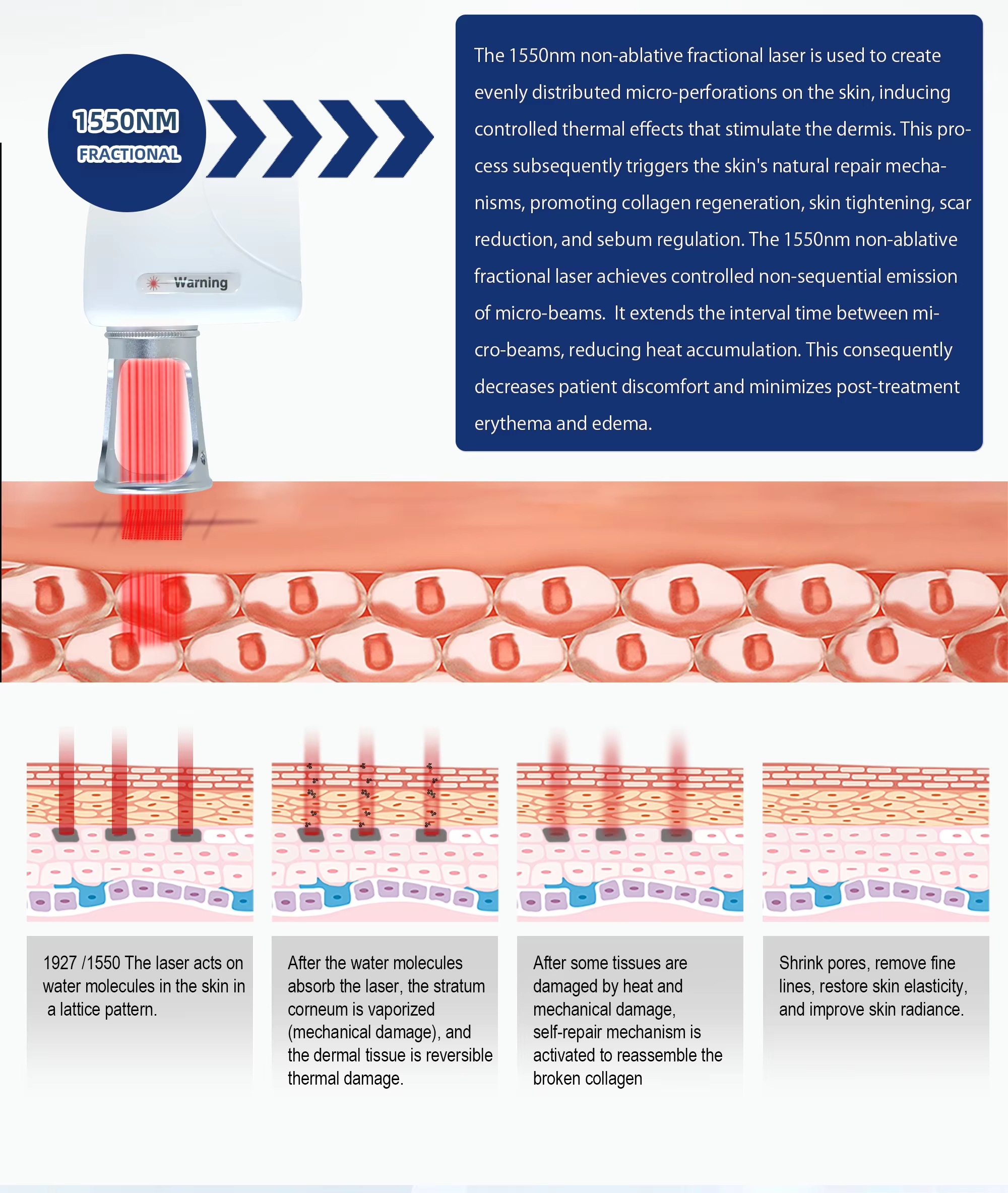 Dual-Wavelength（1927nm+1550nm） Thulium Laser System ThulDuo HY200